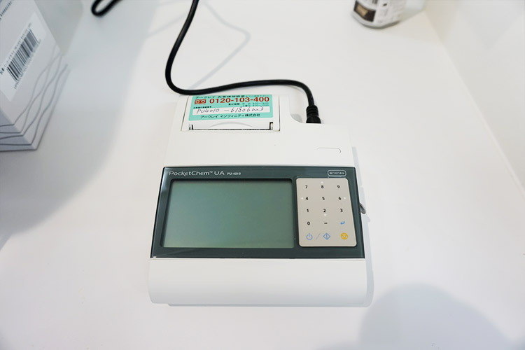 小型尿化学分析装置